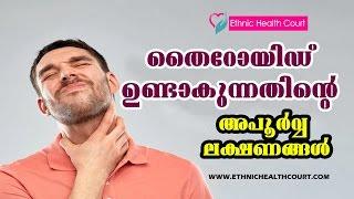 12 Major Signs & Symptoms of Thyroid Disease | Ethnic Health Court