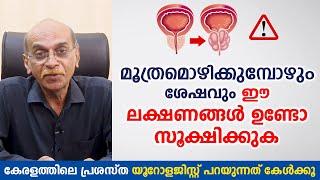 മൂത്രമൊഴിക്കുമ്പോഴും ശേഷവും ഈ ലക്ഷണങ്ങൾ ഉണ്ടോ സൂക്ഷിക്കുക\ Prostate \ Arogyam