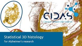 Statistical 3D histology for Alzheimer's research using linearized optimal transport