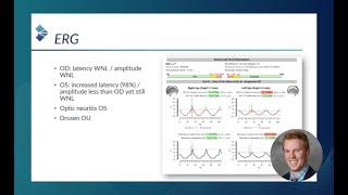 RETeval Optometric Case:  Routine ERG Use Supports Patient Management (by Bradley Grant, OD)