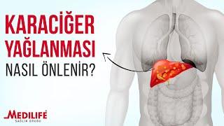 Karaciğer yağlanması nasıl önlenir?