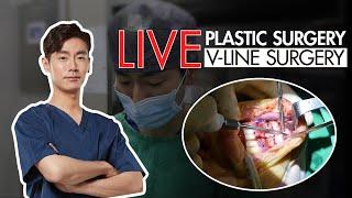 LIVE Plastic Surgery Video_V-LINE SURGERY 