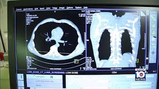 American Lung Association releases information about lung cancer rates in Florida