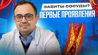 Забиты сосуды? Первые признаки атеросклероза!