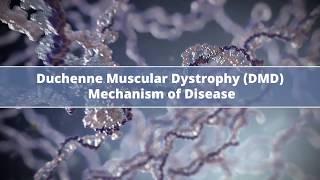 Duchenne Muscular Dystrophy (DMD) Mechanism of Disease