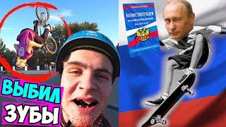 СЛОМАЛ ЗУБЫ на BMX