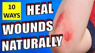 10 Natural Ways To Heal Wounds And Scrapes Fast & Quickly