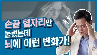 뇌가 맑아지는 혈자리[머릿속이 답답, 두통, 어지러움, 집중력, 기억력까지]