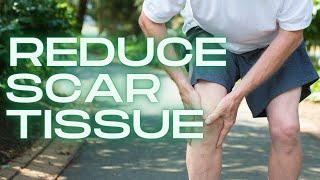 How to Get Rid of Knee Scar Tissue NOW (& Naturally)