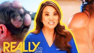 Dr Lee's Most Wholesome Transformations! | Dr Pimple Popper