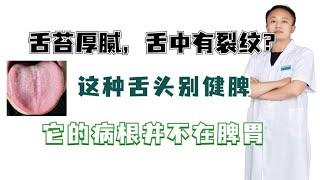 舌苔厚腻，舌中有裂纹？这种舌头别健脾，它的病根并不在脾胃