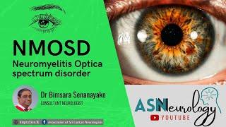 Neuromyelitis Optica Spectrum Disorder By Dr Bimsara Senanayake