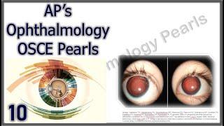 AP's Ophthalmology OSCE Pearls 10