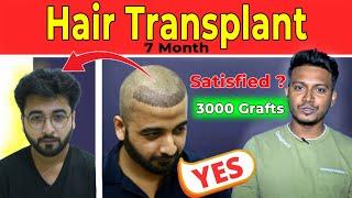 Life After Hair Transplants II What to Expect & How to Care for Your New Hair