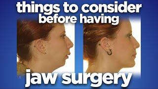 Things to consider before having jaw surgery by dr Mike Mew