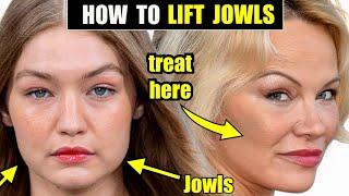 How to Lift & Tighten the Jowls with Sculptra-FDA Proven to Tighten Skin & Improve Jawline Contour!