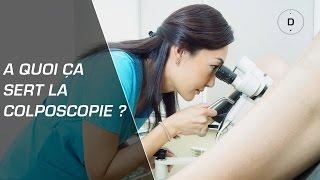 A quoi sert la colposcopie ? - Gynécologie