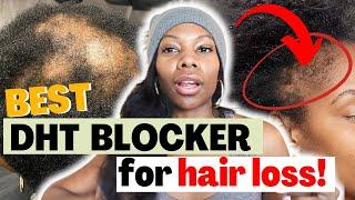 DHT Blockers for Hair Growth: Understanding The Hype and The Science!