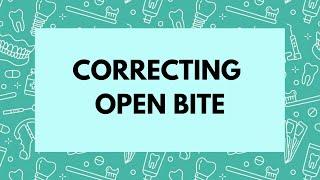 Management of Open bite -Orthodontics