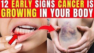 12 Early Cancer Signs You Can’t Ignore!| Healthy Care