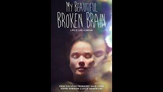 My Beautiful Broken Brain (2014 Documentary)