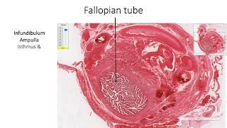 Histology with Chimmalgi: Fallopian Tube