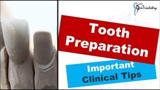 CLINICAL TIPS for TOOTH PREPARATION/CROWN PREPARATION