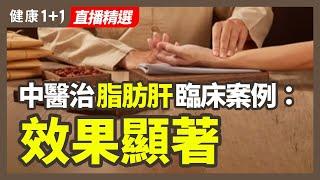 中醫治療脂肪肝臨床案例 效果顯著 | 健康1+1 · 直播精選