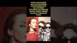 BİRCE AKALAY'IN ESTETİKSİZ HALİ SOSYAL MEDYADA GÜNDEM OLDU!