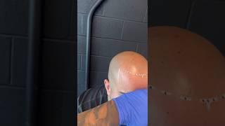 What just happened ?!? Scalp Micropigmentation Toronto | Canada #smptoronto