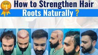 Hair Transplant in Delhi | Best Results & cost of Hair Transplant in Delhi