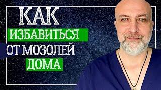 Как избавиться от мозолей | Простой способ Как лечить в домашних условиях