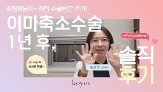 #Forehead reduction surgery review by the doctor (Dr. Cho, Gangnam Koyou Plastic Clinic, Korea)