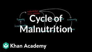 Cycle of Malnutrition