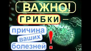 Грибки- паразиты. Плесневые, дрожжевые грибки- микромицеты вызывают полипы, онкологию и т.д..