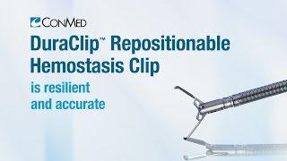 DuraClip® Repositionable Hemostasis Clip - CONMED Product Video