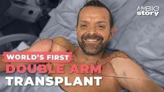 World's First Double Arm Transplant: 'It's Science Fiction'