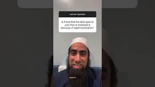 Is it true that the dark spot on your foot or forehead is because of sajda "prostration"