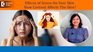 4 Ways how Stress affects the Skin|Too HIGH Cortisol & effects on skin-Dr.Amee Daxini|Doctors'Circle