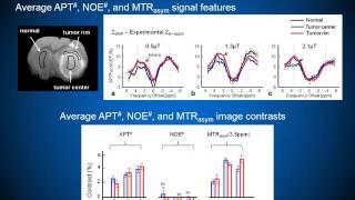 Hye Young Heo: Application of CEST in Tumor Detection