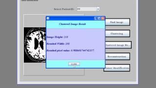 Brain Tumour Segmentation Java project