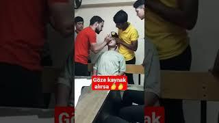 Göze kaynak aldığında 1 damla limon ile tedavi #shorts #aboneol #takipet