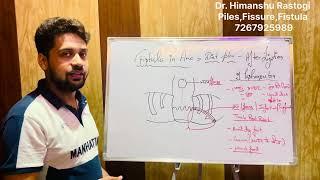 fistula in ano - diet plan , after ligation of ksharsutra.