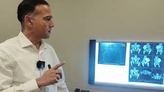 Hip Dislocation #Elderly  Patients #Rajasthan #Hip Fracture #How to Treat #How to Care