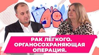 Рак легких. Как сохраняют орган при лечении рака легких. Бронхопластика. Левченко Никита