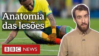 As lesões mais comuns no futebol e como preveni-las