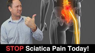 Best RELIEF EXERCISES to Stop Sciatica Pain!  3 Exercises For Fast Relief.