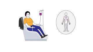 Cancer Basics – How chemotherapy works