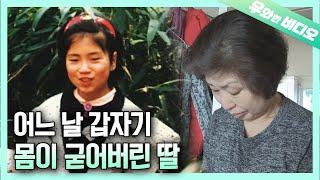 어느 날 갑자기 몸이 굳어버린 딸, 그 곁을 16년 동안 지킨 엄마┃16 Years of Taking Care of a Stiff Daughter