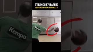 Люди буквально вывернули свои конечности!